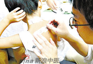 灸法的種類  你知道多少？
